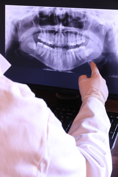 Best Emergency Dental Care for Abscessed Tooth in Covington, TN